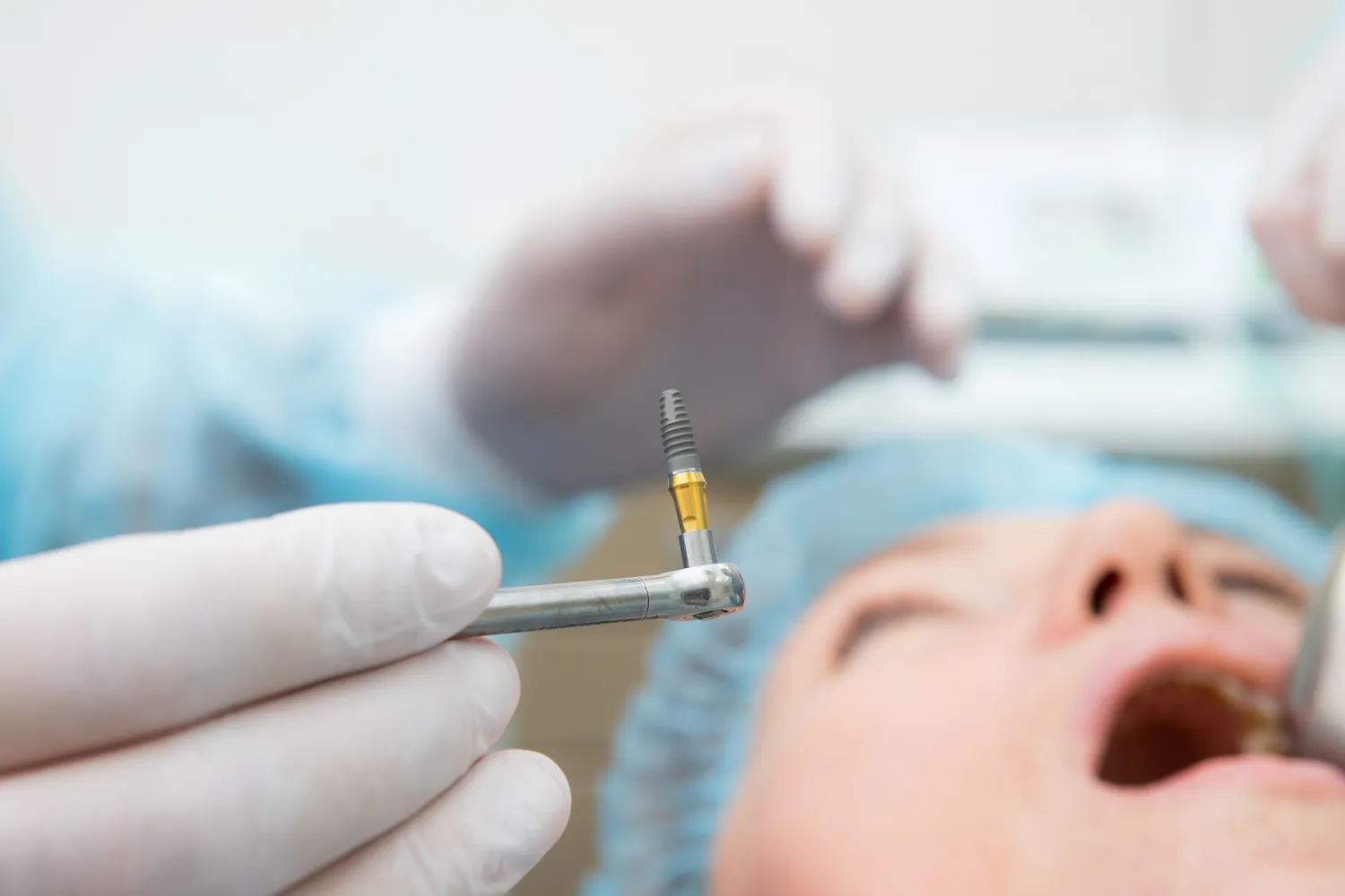 Endodoncja stomatologiczna Szczecin